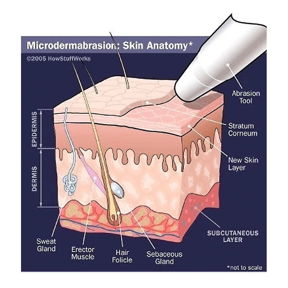 Microdermabrasion Crystals, All-Natural Skin Face Exfoliator (4 lb, 120 Grit) H905879